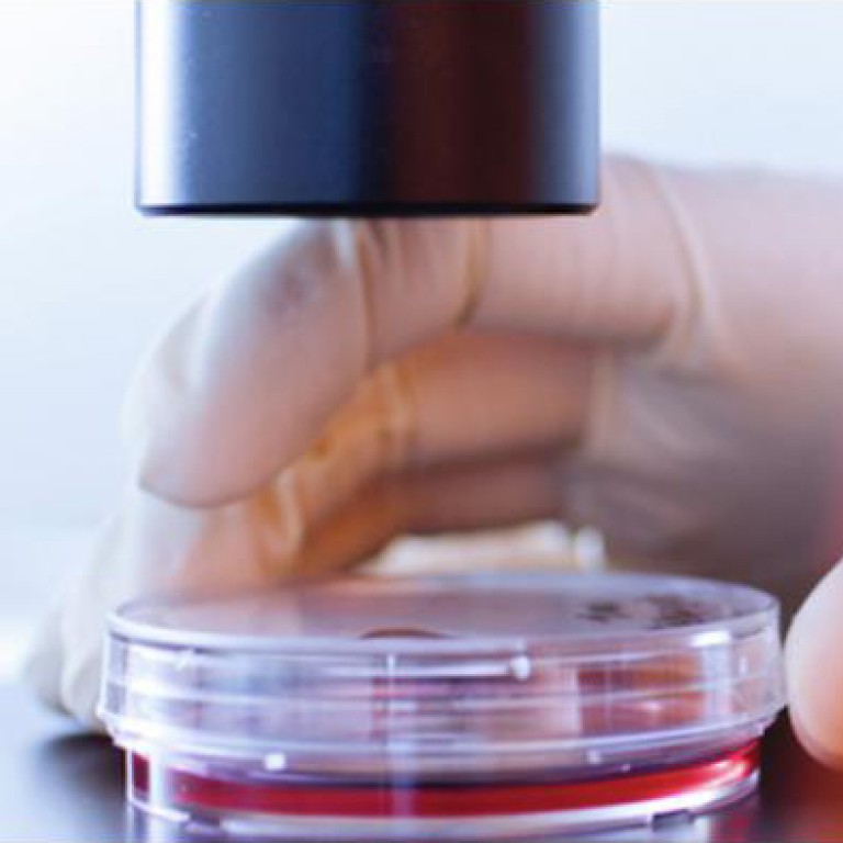 Amber UV Window Film